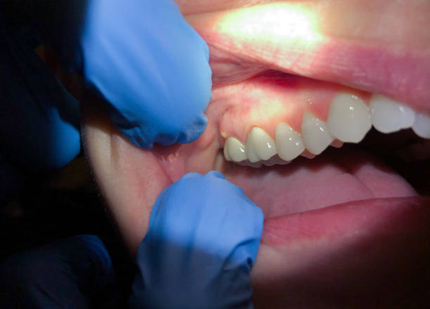 Best Emergency Orthodontic Repairs in Ishpeng, MI